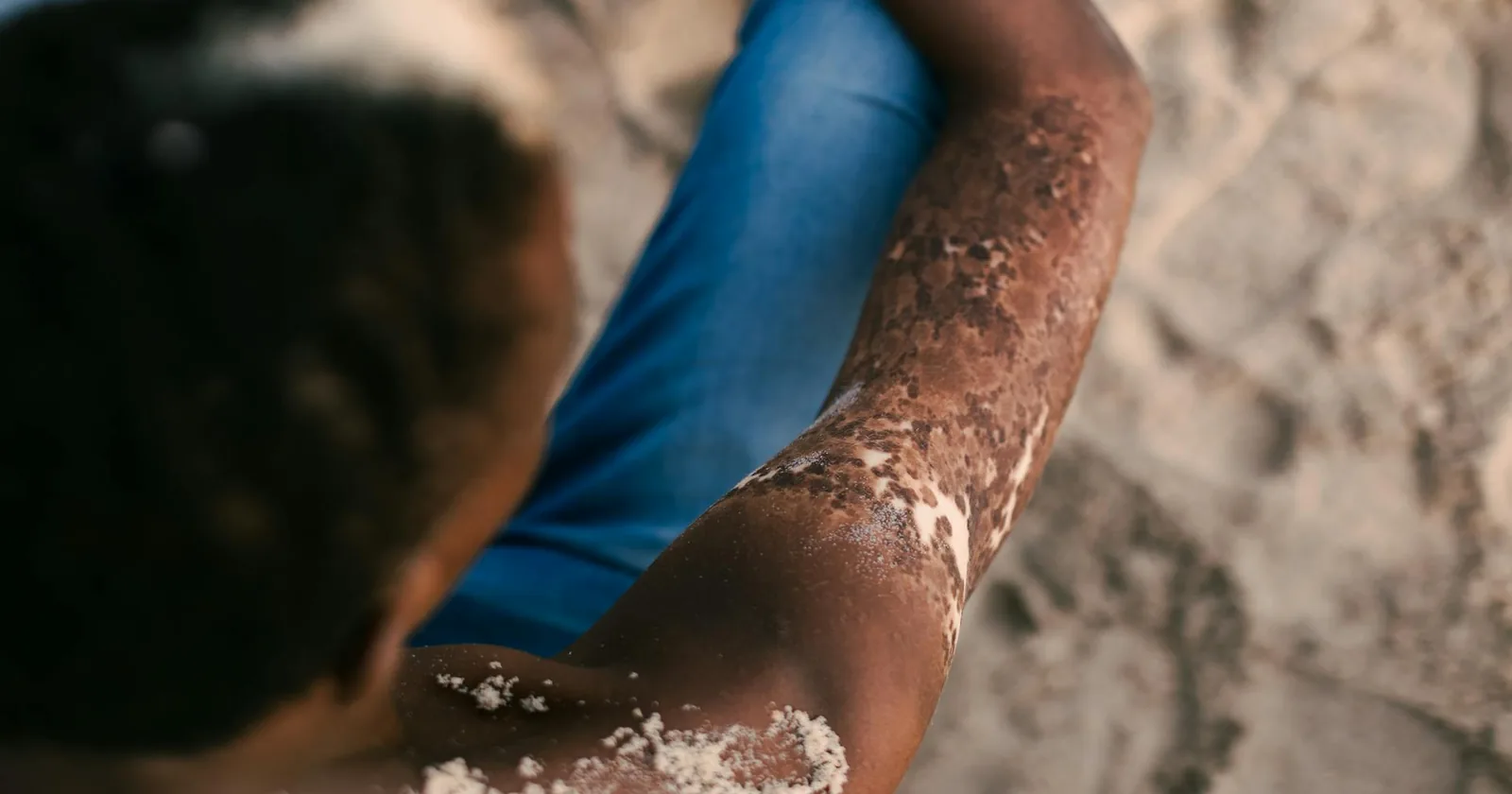 A person sits on a sandy beach in the warm sun, the kind of everyday exposure many assume is enough to keep vitamin D levels in range.